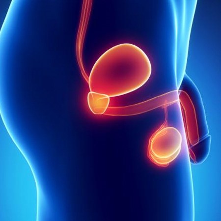 Diagnosis Hypogonadism