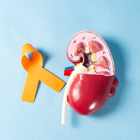 Kidney Cancer Treatment & Surgery Meerut