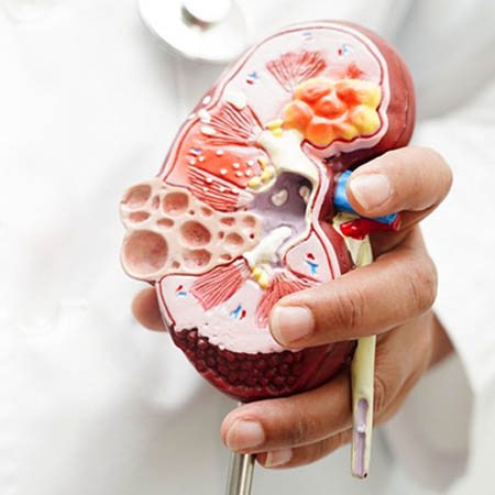 Best Medical Renal Disease Management Meerut