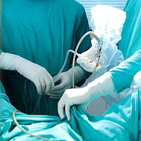 PCNL Recovery Specialists Meerut