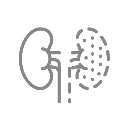 Laparoscopic Partial Nephrectomy Recovery Specialists Meerut