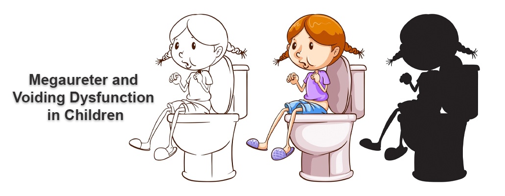  Megaureter Voiding Dysfunction Treatment Meerut