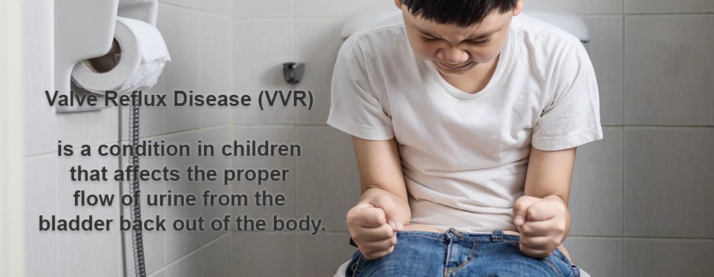 Valve Reflux Disease Treatment Meerut