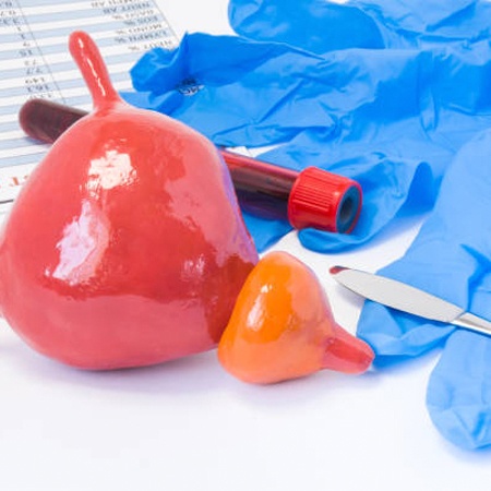 Best Urologist for BiPolar TURP Meerut