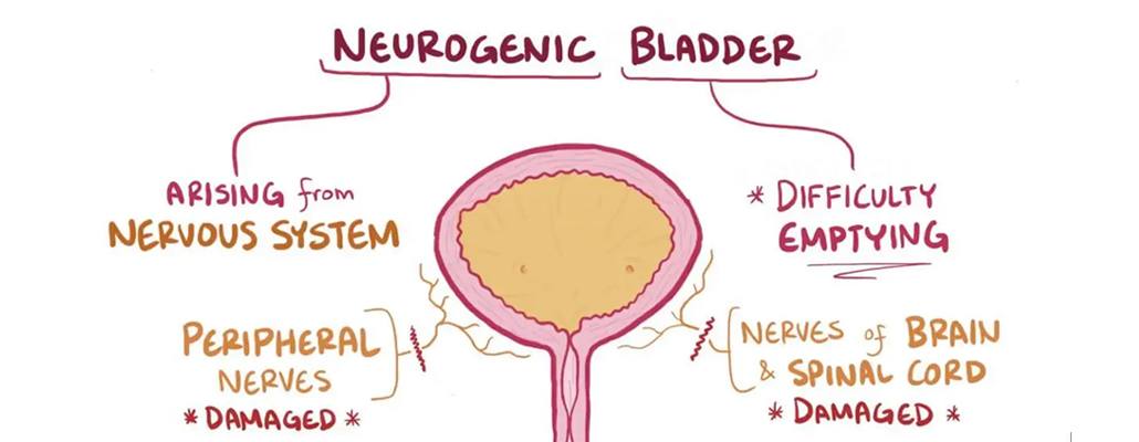 Neurogenic Bladder Treatment & Surgery Meerut